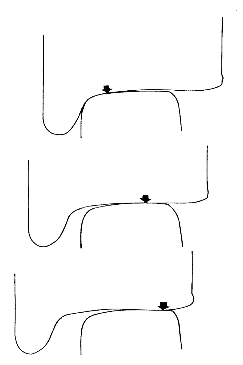 Fig 6.